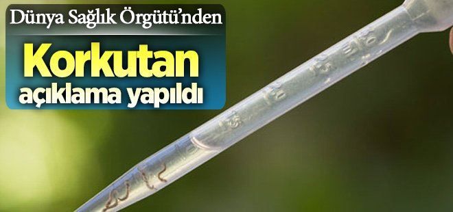 Dünya için korkutan ´Zika´ açıklaması